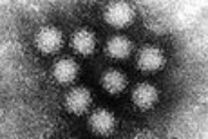 Enfermedad a bordo: Norovirus.